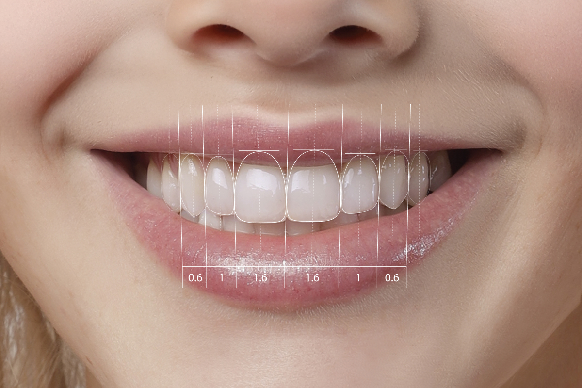 Cosmetic Dentistry